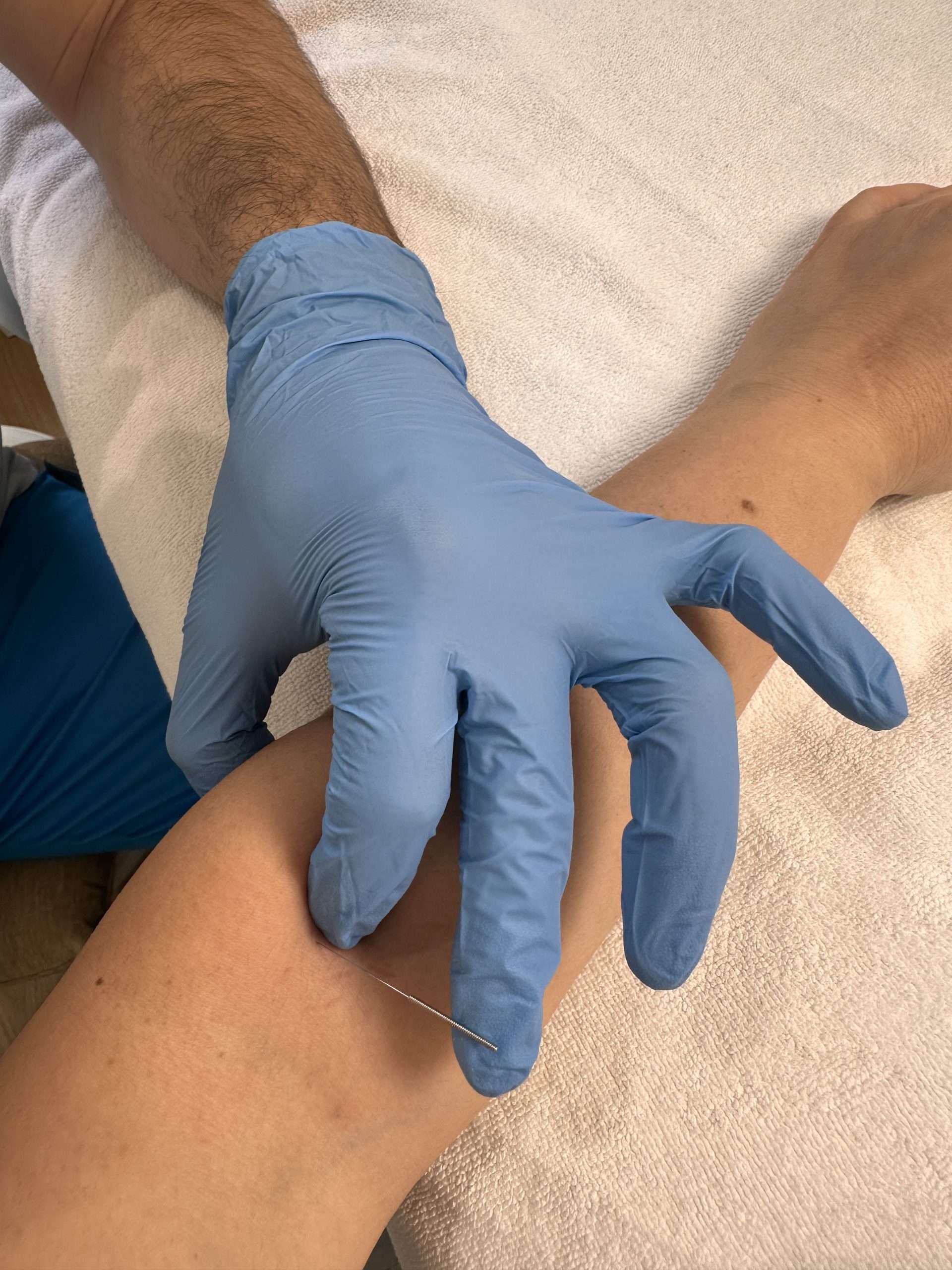 dryneedling