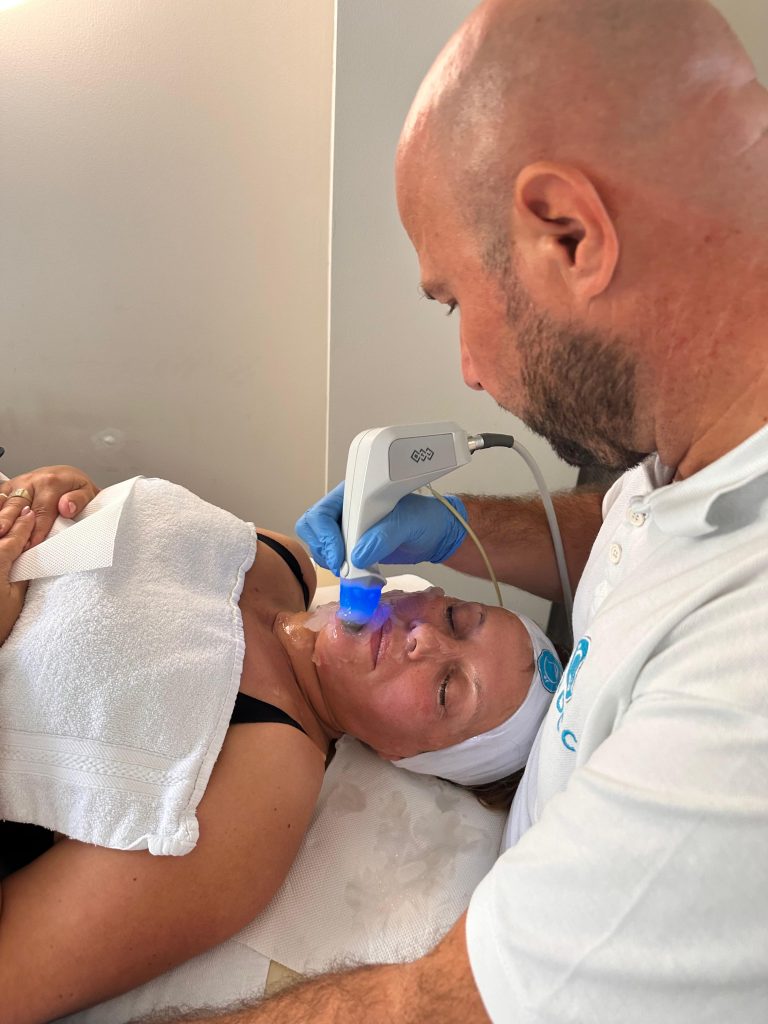 face lifting - zatezanje kože lica