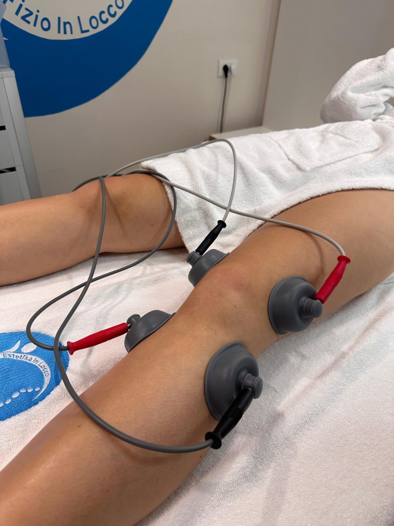 istegnuti ligamenti kolena