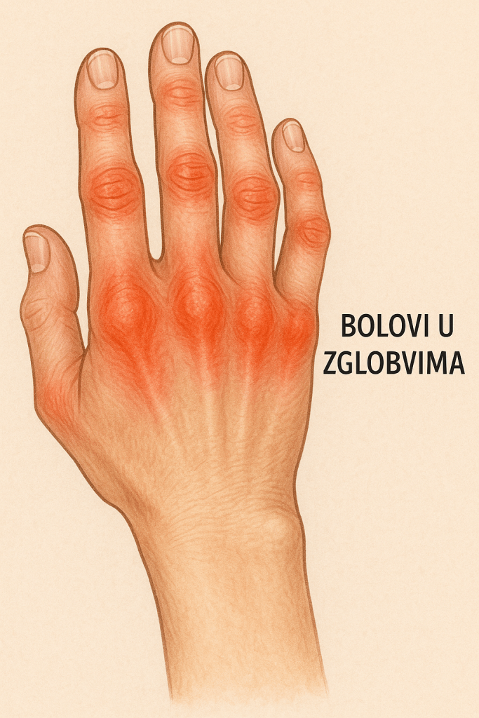 bolovi u zglobovima