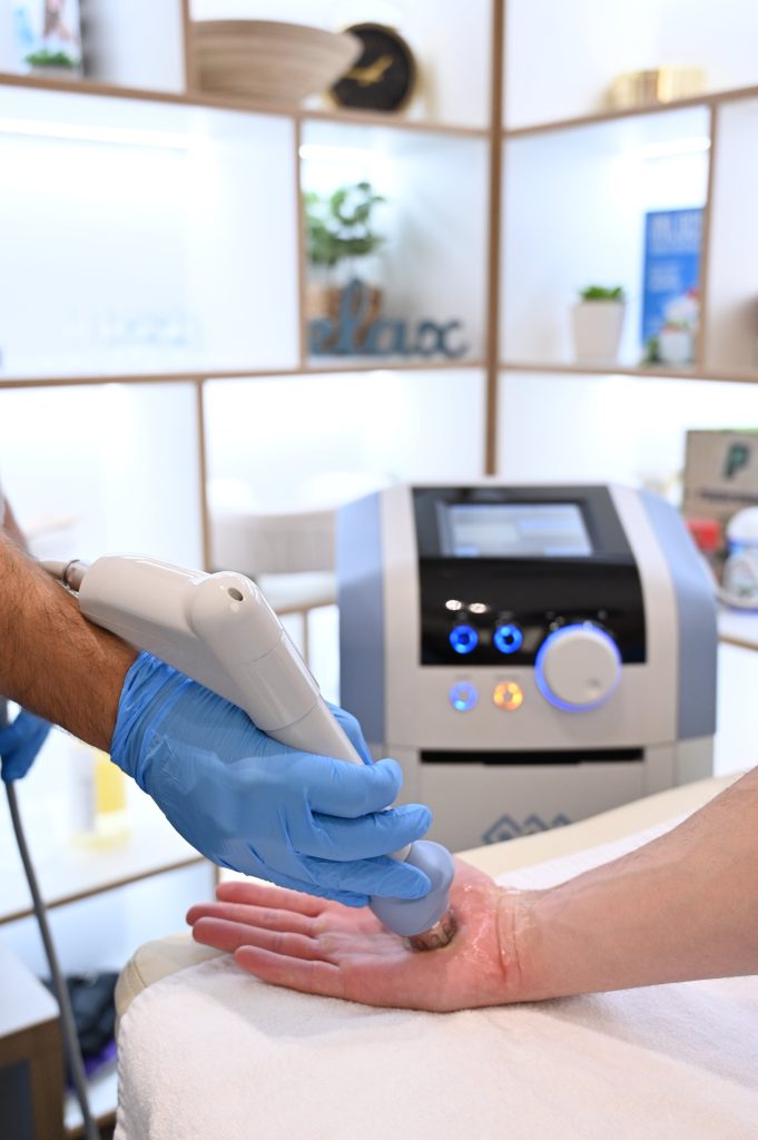 sindrom karpalnog tunela