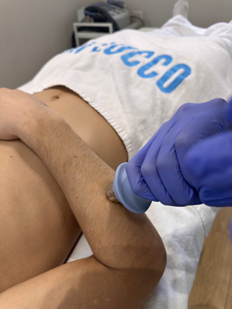 bol od lakta do šake u desnoj i levoj ruci