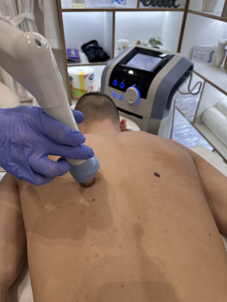 bol u grudnoj kosti zbog kičme lečenje