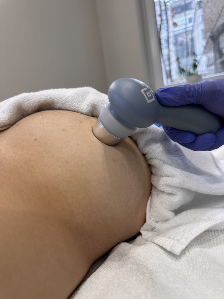 bol u trtičnoj kosti lečenje