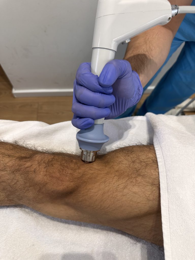 povreda kolena lečenje i rehabilitacija